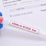 ૧ જાન્યુઆરી ૨૦૨૩થી આ ૬ દેશમાંથી આવતા મુસાફરો માટે RT-PCR ટેસ્ટ ફરજિયાત રહેશે 3 File 01 Page 01 7