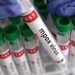 ભારતમાં ખતરનાક વાયરસની એન્ટ્રી, દિલ્હીમાં મળ્યો પહેલો કેસ 2 Entry of monkeypox into India, virus confirmed in patient in Delhi