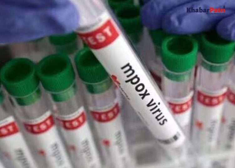 Entry of monkeypox into India, virus confirmed in patient in Delhi