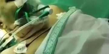 A woman underwent a brain operation while watching Junior NTR's film in the operation theatre