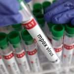 સાવધાન! ભારતમાં Mpoxના ખતરનાક સ્ટ્રેનની એન્ટ્રી, મળ્યો પ્રથમ દર્દી 3 mpox